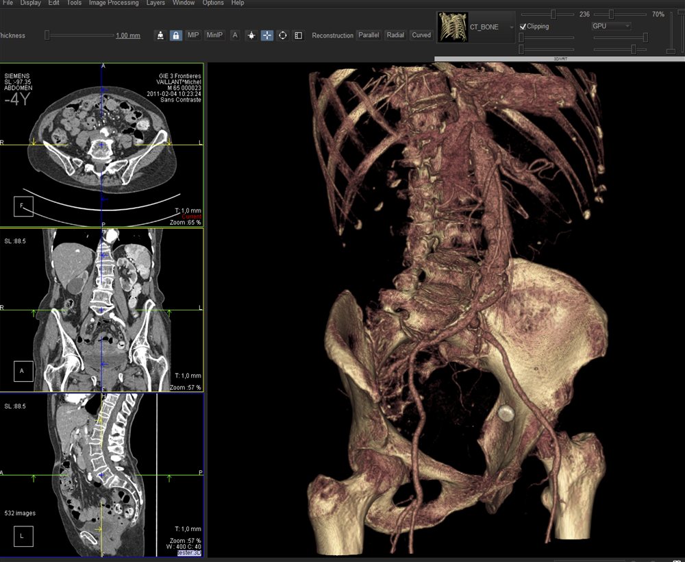 Medical imaging